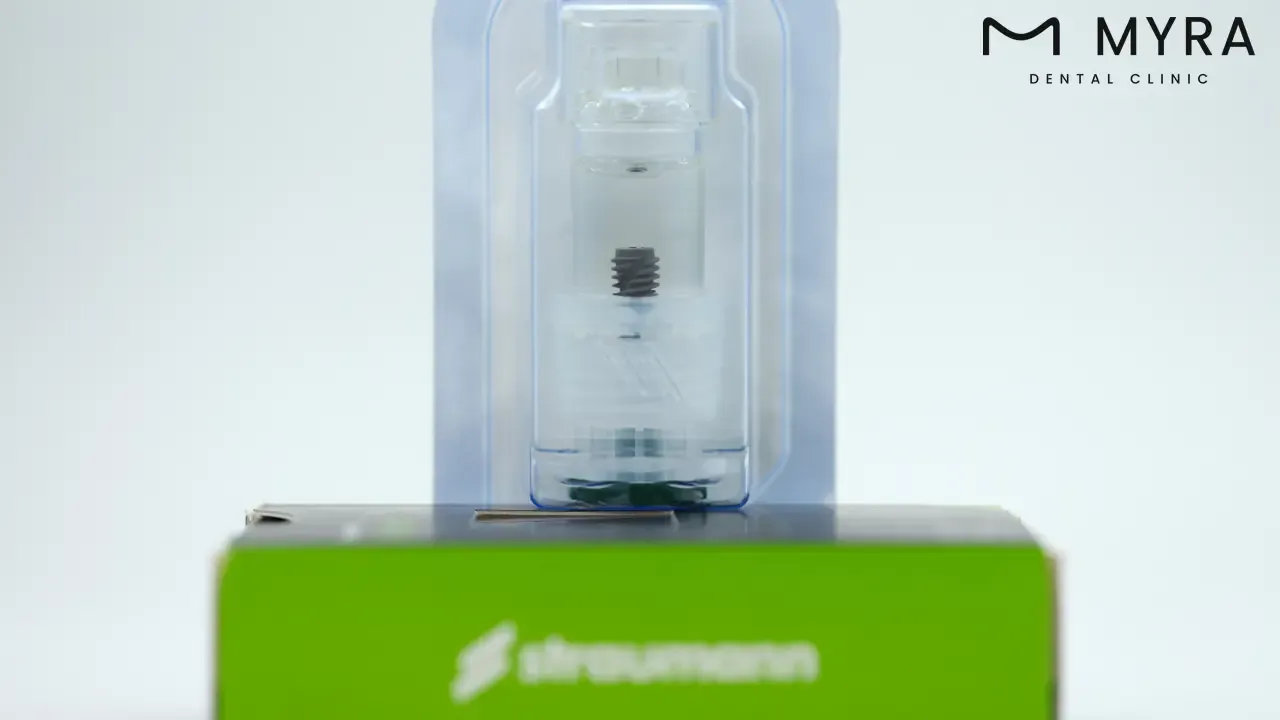 immediate load dental implants.webp